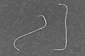 Leptospira con la clásica forma helicoidal de las bacterias Espiroquetas